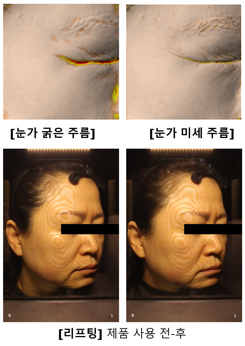 탄력 및 리프팅 개선 원본 이미지