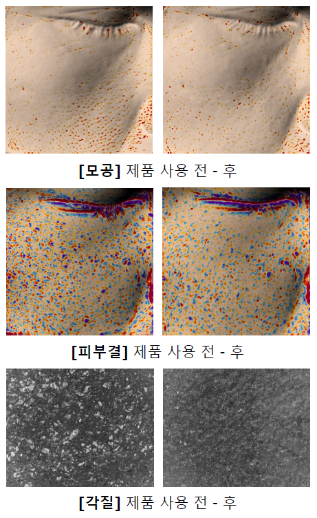모공 및 피부결 개선 원본 이미지